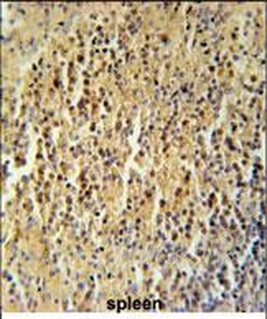 CC106 Antibody (Center)