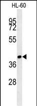 SIA8C Antibody (C-term)