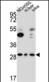 TAF1D Antibody (N-term)