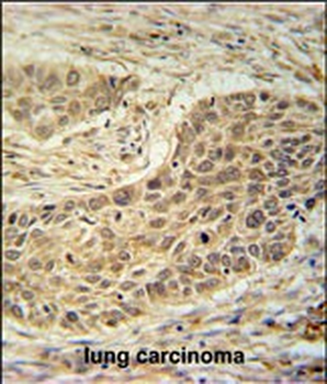 TAF1D Antibody (N-term)