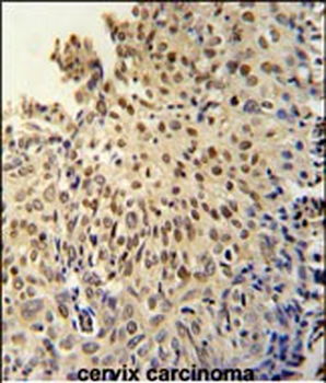 DI3L1 Antibody (N-term)