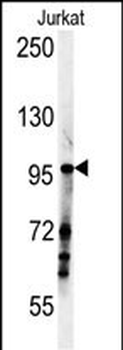SPAG1 Antibody (N-term)