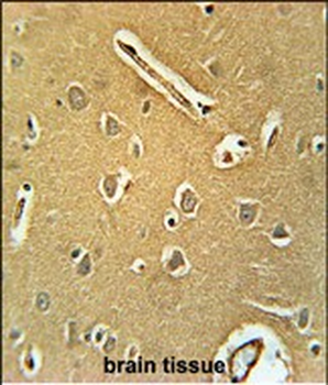 RNF208 Antibody (Center)