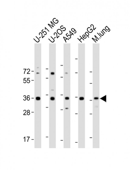 RCN3 Antibody (Center)