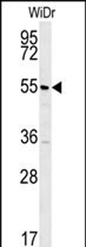 TSPYL4 Antibody (N-term)