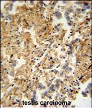 ZMYND10 Antibody (C-term)