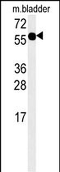 ADSSL1 Antibody (N-term)