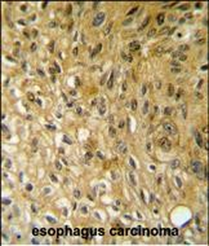 SAMSN1 Antibody (Center)