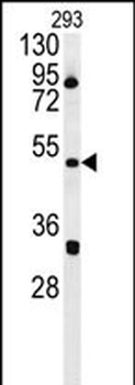 ILKAP Antibody (Center)
