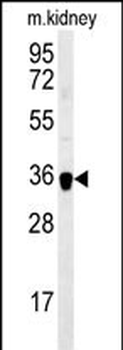 ILKAP Antibody (Center)