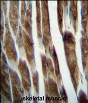 ILKAP Antibody (Center)