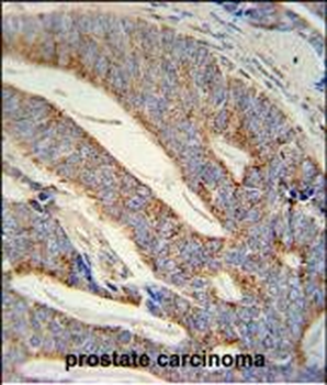 DACT1 Antibody (N-term)