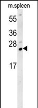 TMUB1 Antibody (Center)