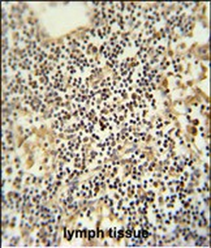 TMUB1 Antibody (Center)