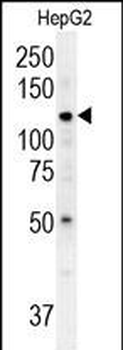 ATP13A3 Antibody (N-term)