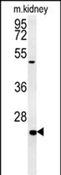 SHISA2 Antibody (C-term)
