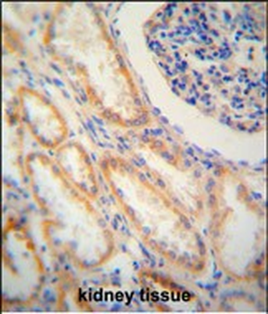 SHISA2 Antibody (C-term)