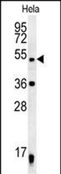 DDX47 Antibody (C-term)