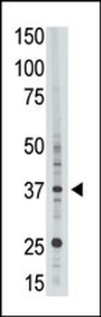 EPR1 Antibody (C-term)