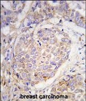 MAGEA10 Antibody (C-term)