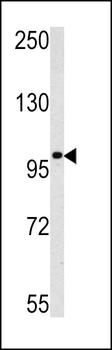 MAGEC1 Antibody (C-term)