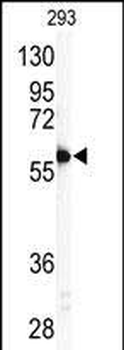 MMP11 Antibody (C-term)