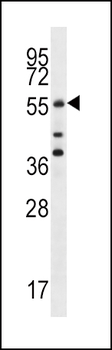 Cdc25A Antibody (S78)