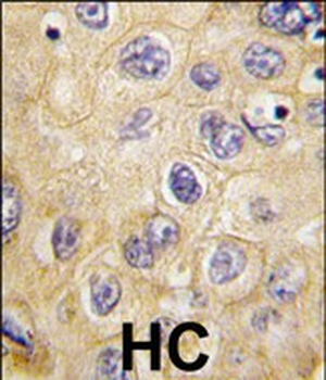 Claudin 1 (CLDN1) Antibody (Loop1)