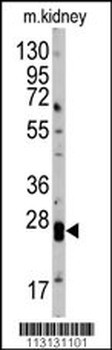 Claudin 1 (CLDN1) Antibody (Loop2)