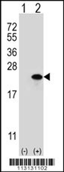 Claudin 1 (CLDN1) Antibody (Loop2)
