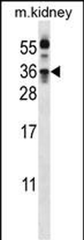 Kallikrein 8 Antibody (Center)