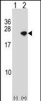 SNCA Antibody (C-term)