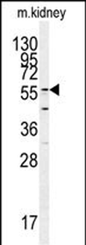 GADL1 Antibody (C-term)
