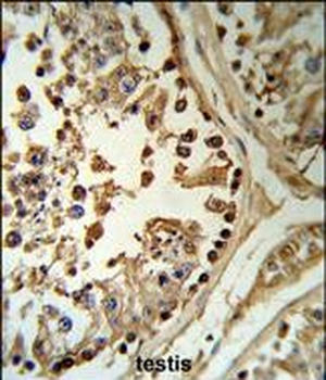 SETD8 Antibody (Center)