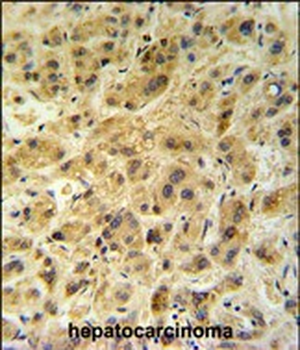 GNS Antibody (Center N189)
