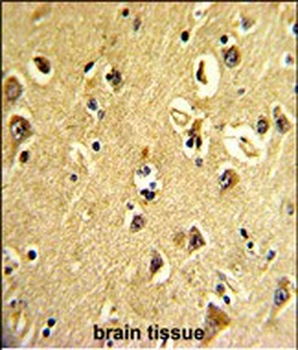 ARPC3 Antibody (C-term)