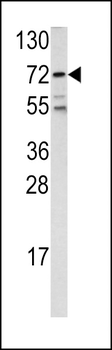 FKHR Antibody (Center D469)
