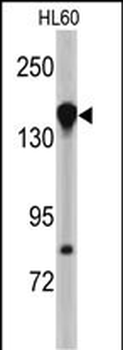 NUP155 Antibody (N-term)