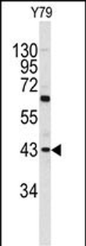 PRELP Antibody (C-term)
