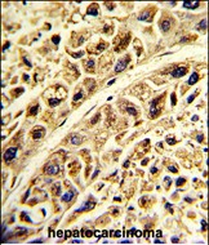 PRELP Antibody (C-term)
