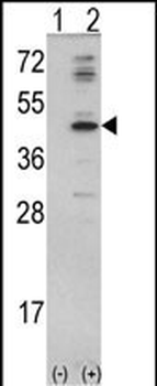 MVD Antibody (N-term)