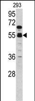 F10 Antibody (C-term)