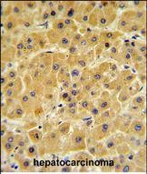 F10 Antibody (C-term)