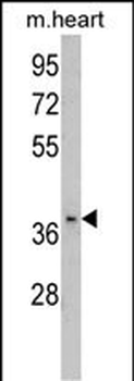 FBP2 Antibody (C-term)