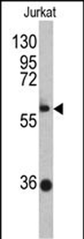 ZBTB2 Antibody (C-term)