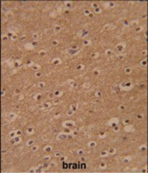 ZBTB2 Antibody (C-term)
