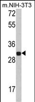 FHL1 Antibody (C-term)