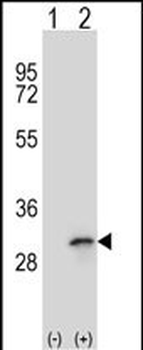 FHL1 Antibody (C-term)
