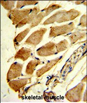 FHL1 Antibody (C-term)