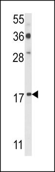 PDRG Antibody (N-term)